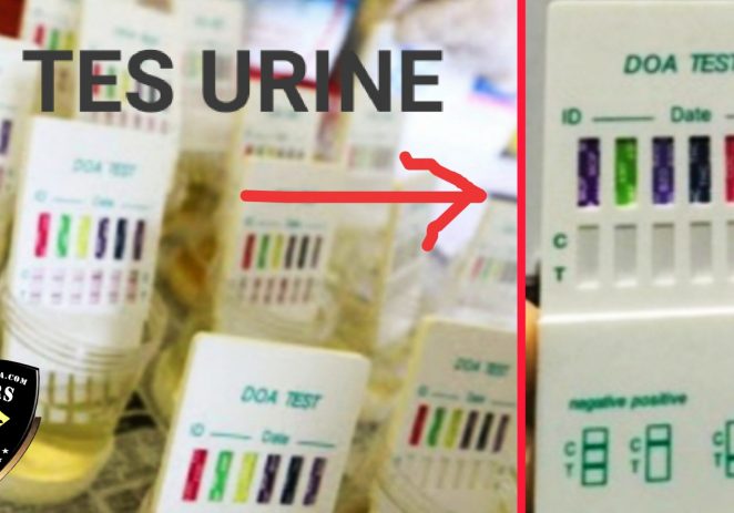 Polda Metro Jaya Akan ‘Tes Urine Mahasiswa’ Di Kampus